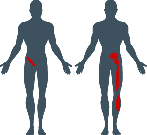 low-back-pain-points-si-joint-dysfunction