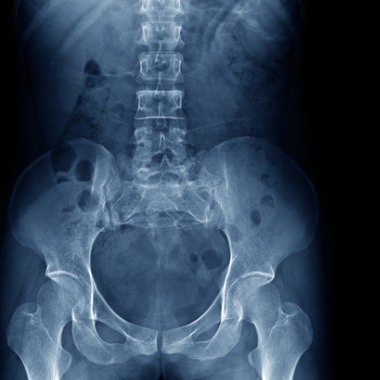 a-simplified-guide-to-getting-an-si-joint-injection