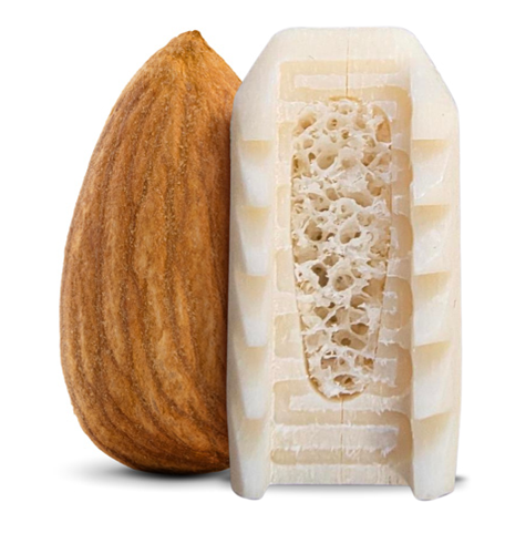 A PainTEQ bone implant photographed next to an almond — about the same size.